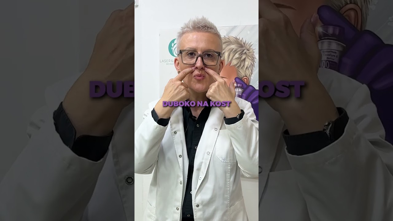 Da li se hijaluronski fileri stavljaju u nazolabijalne bore?