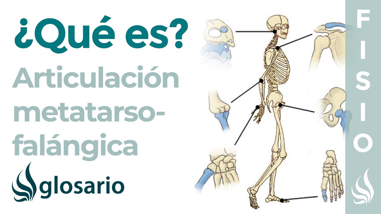 Articulación METATARSOFALÁNGICA | Qué es, partes, tipo de articulación, movimientos y lesiones
