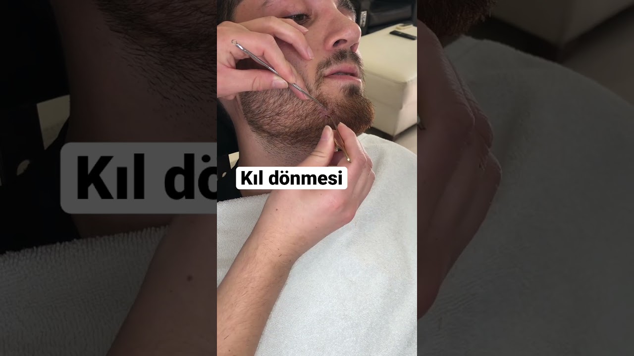 Sivilce i&ccedil;inde oluşan kıl d&ouml;nmesi siz b&ouml;yle birşey yaşadınız mı?