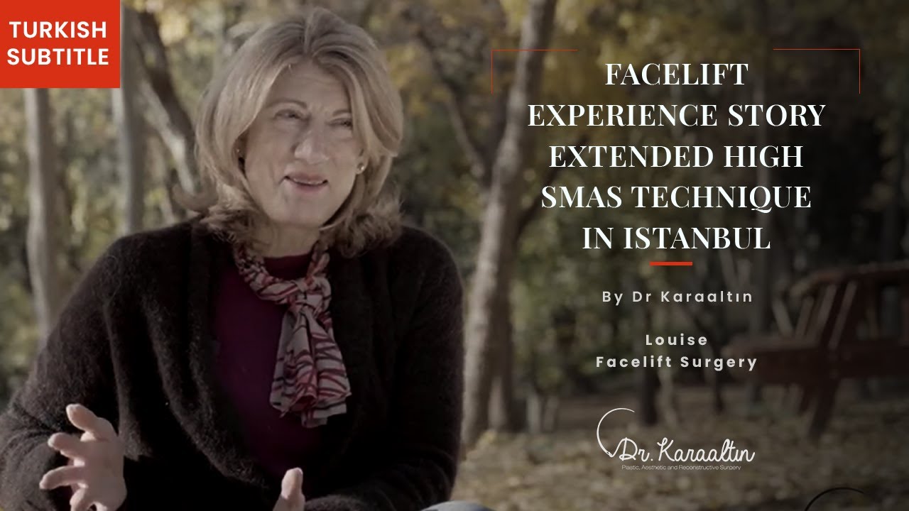 Facelift Experience Story -  Extended High SMAS Technique in Istanbul - DR. KARAALTIN