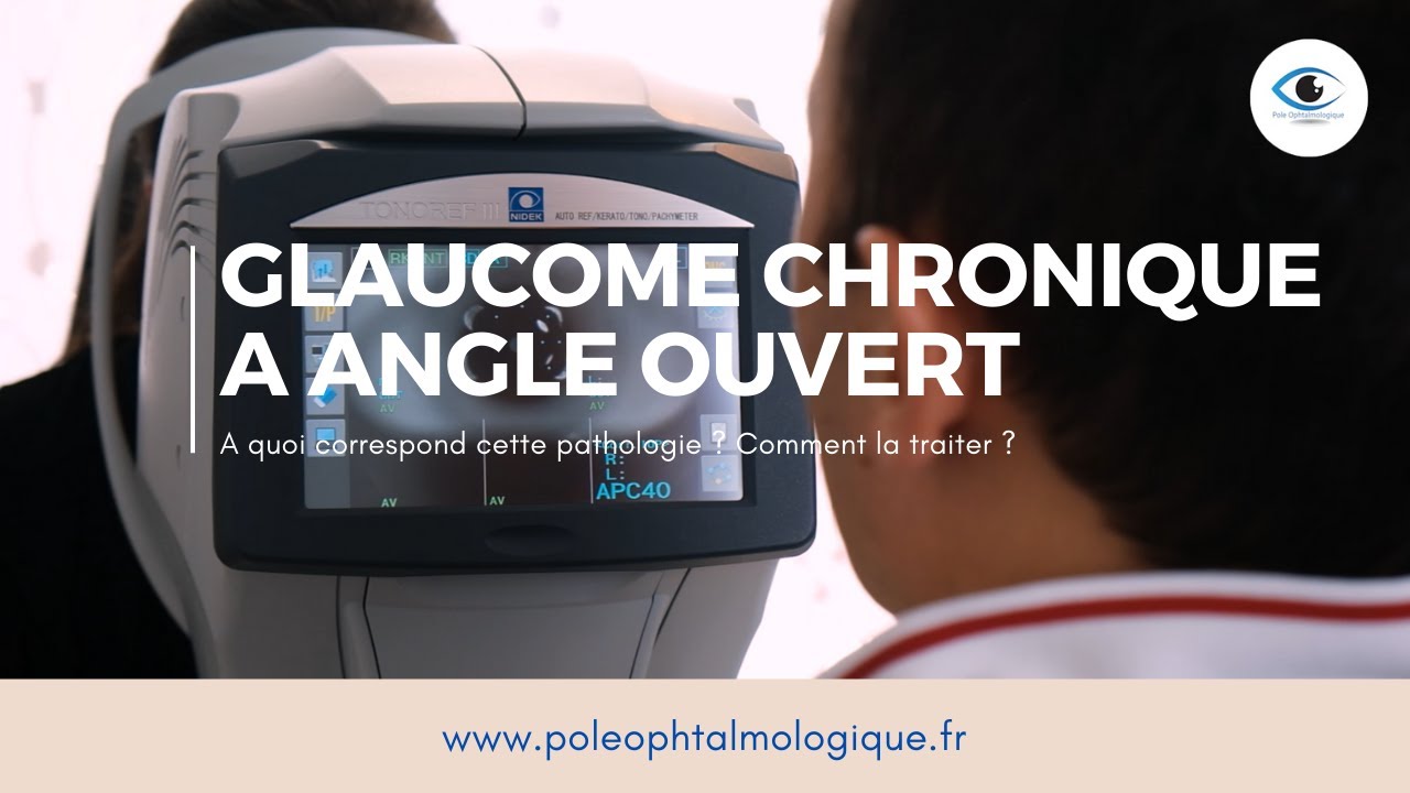 Glaucome chronique à angle ouvert. Pole Ophtalmologique.