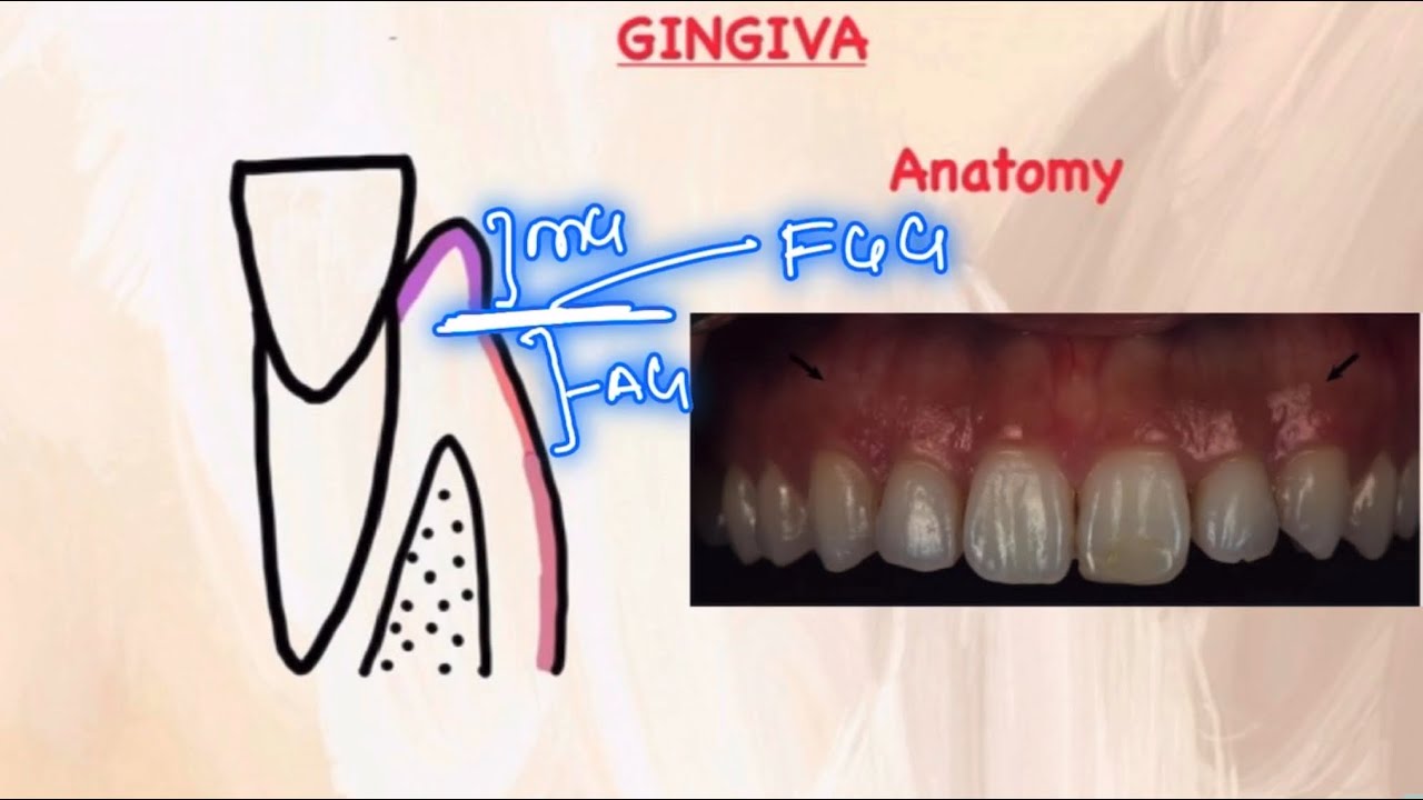 GINGIVA I Anatomy l Macroscopic features I Dental l Carranza - PART 1