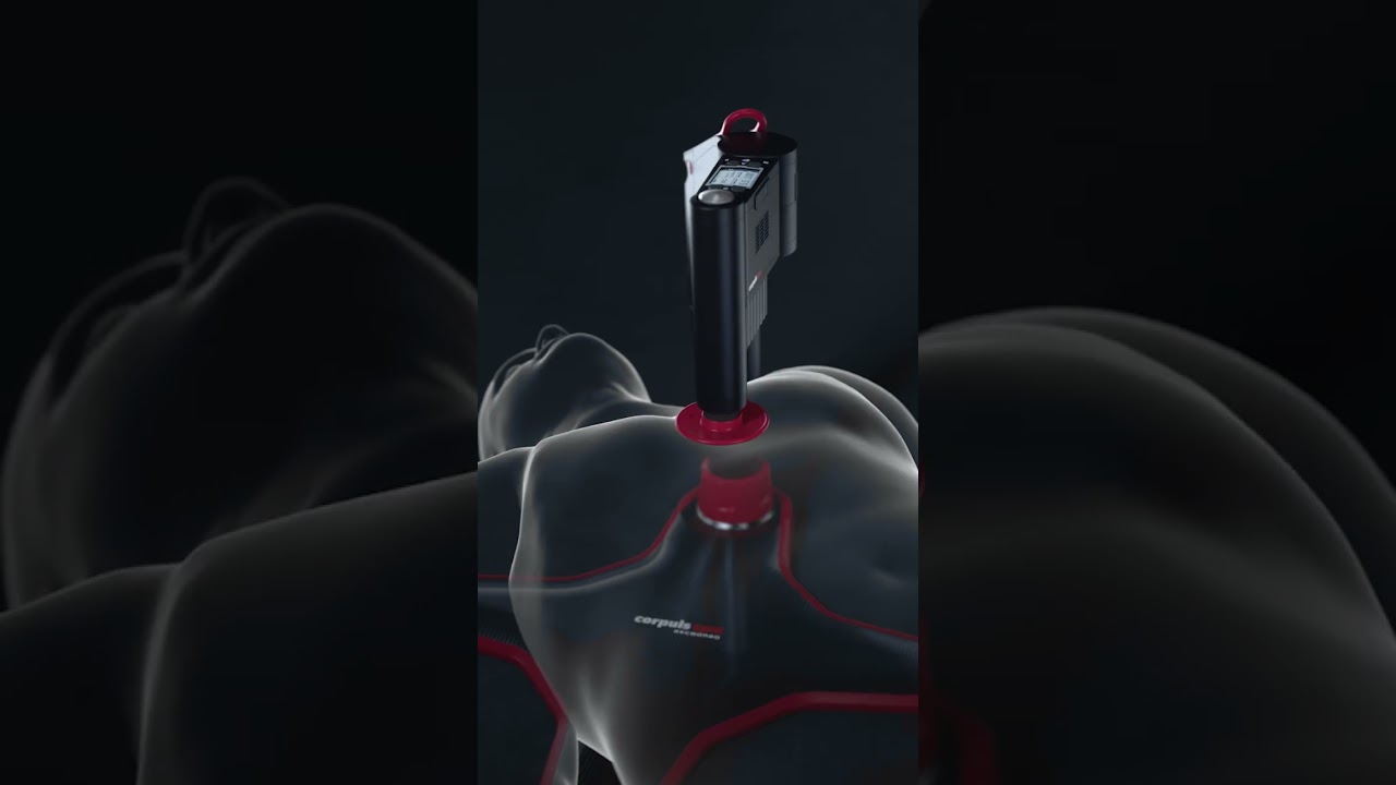 corpuls cpr