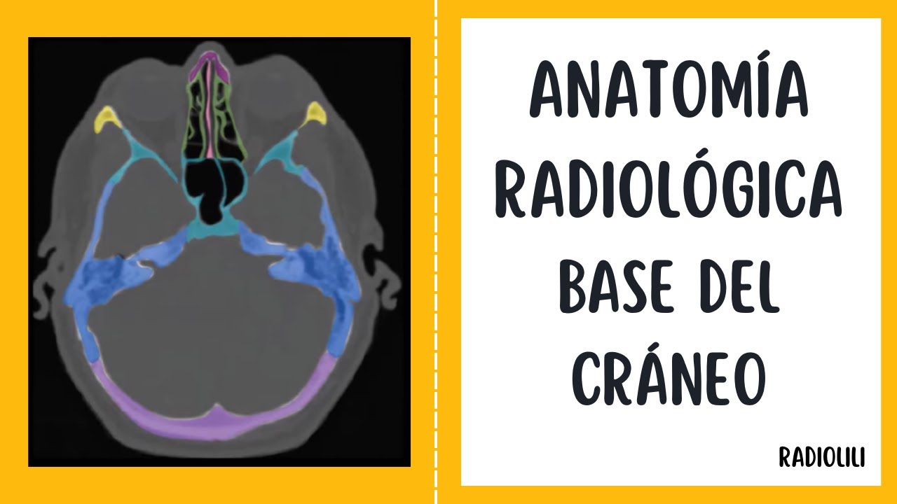 Anatomía Radiológica: Base del Cráneo.