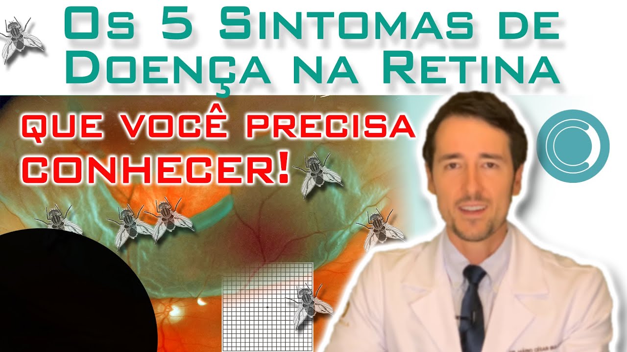 Principais sintomas de doen&ccedil;a na retina.