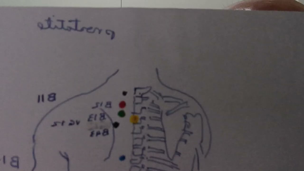 Aliviando os incômodos do enfisema pulmonar, parte 34.