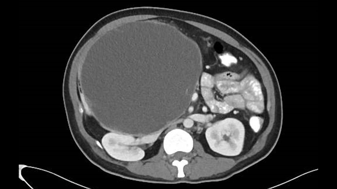 1001 Body Imaging Cases: 0038