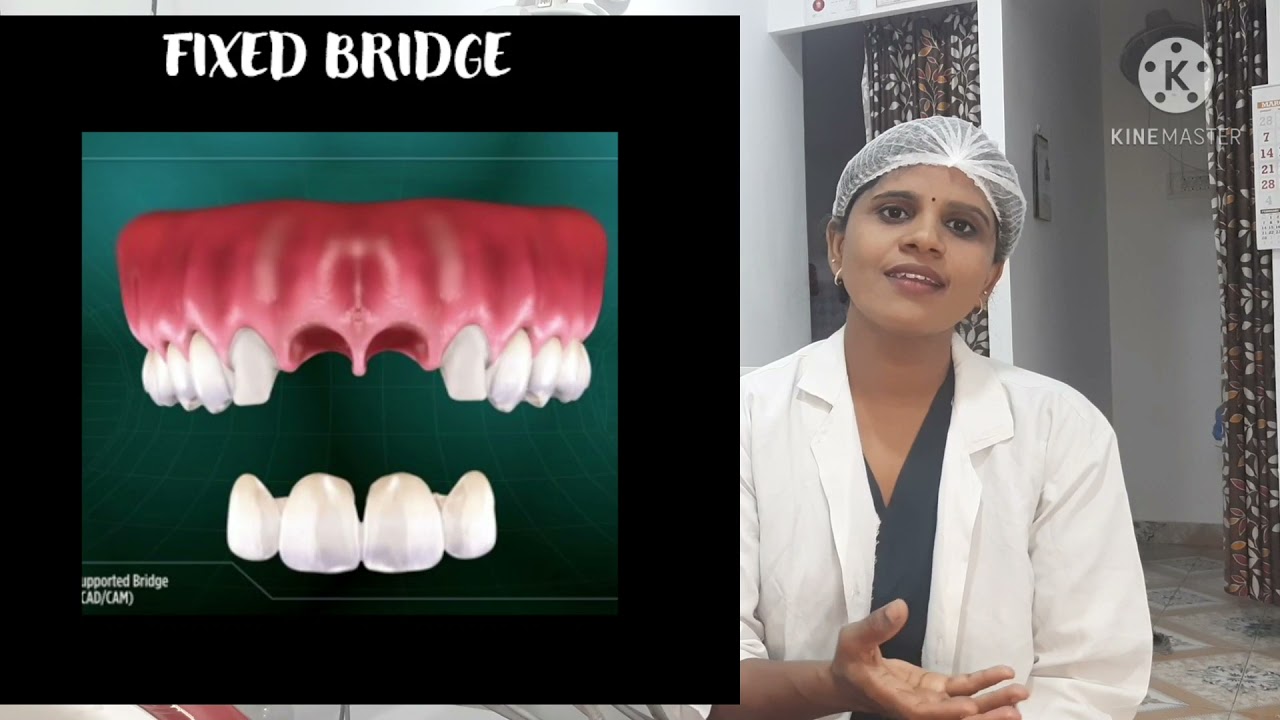 Missing teeth treatment options in tamil