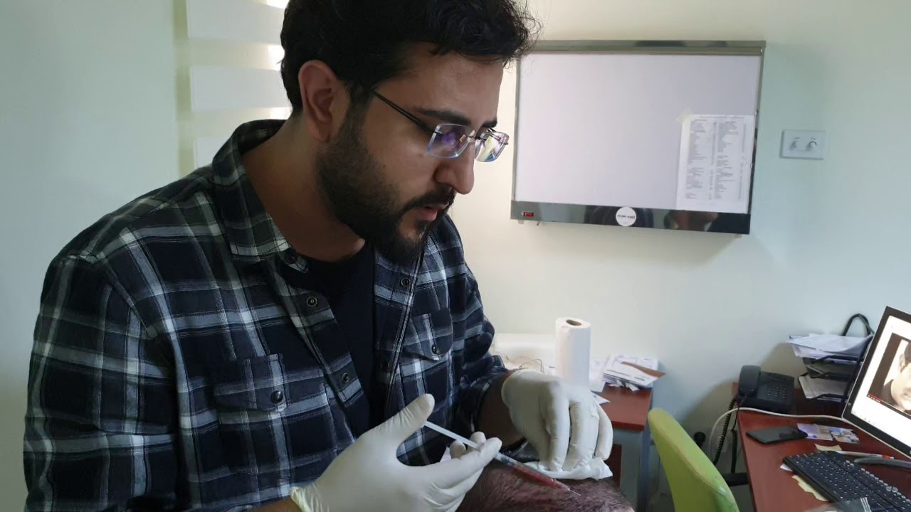 SAÇA PRP İŞLEMİ