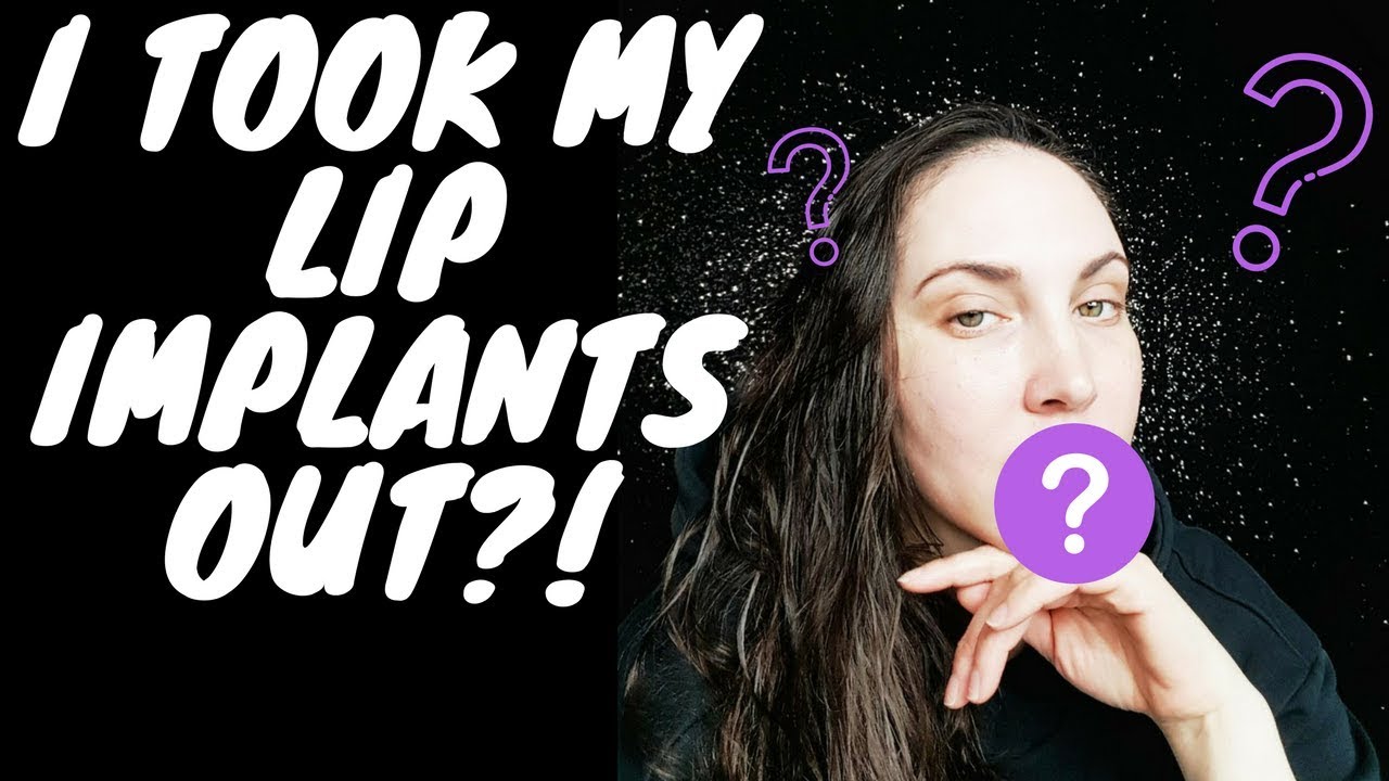 I Took My Lip Implants Out?!!!