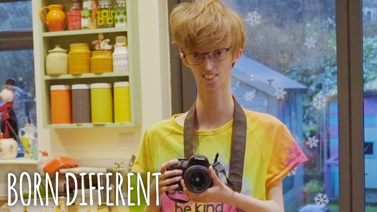 Only 16 People In The World Have My Rare Condition | BORN DIFFERENT