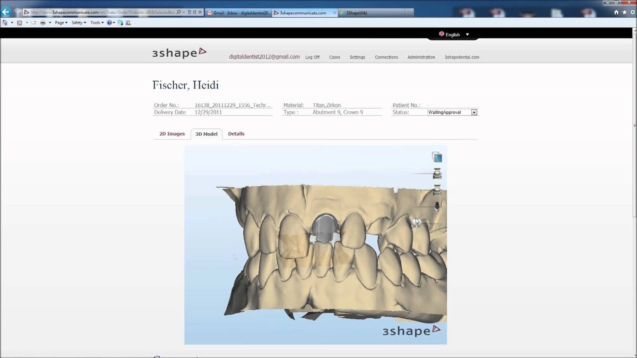 3Shape Communicate Demo