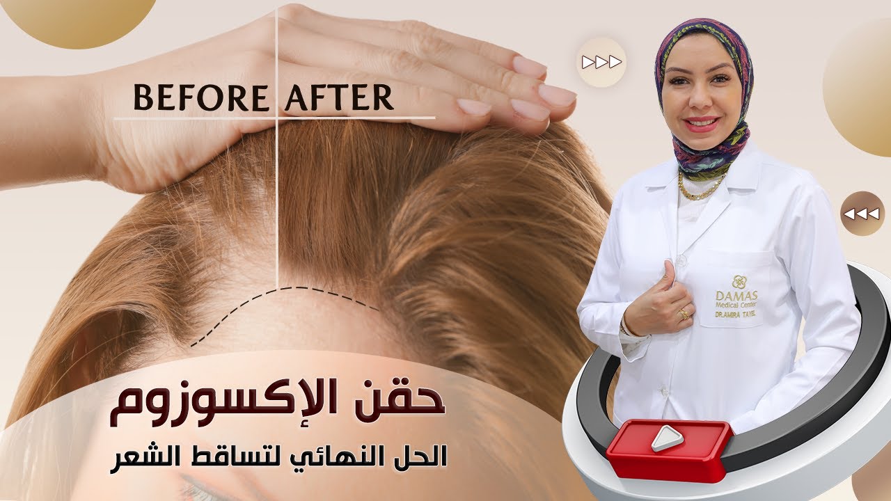 حقن الإكسوزوم: الحل النهائي لتساقط الشعر