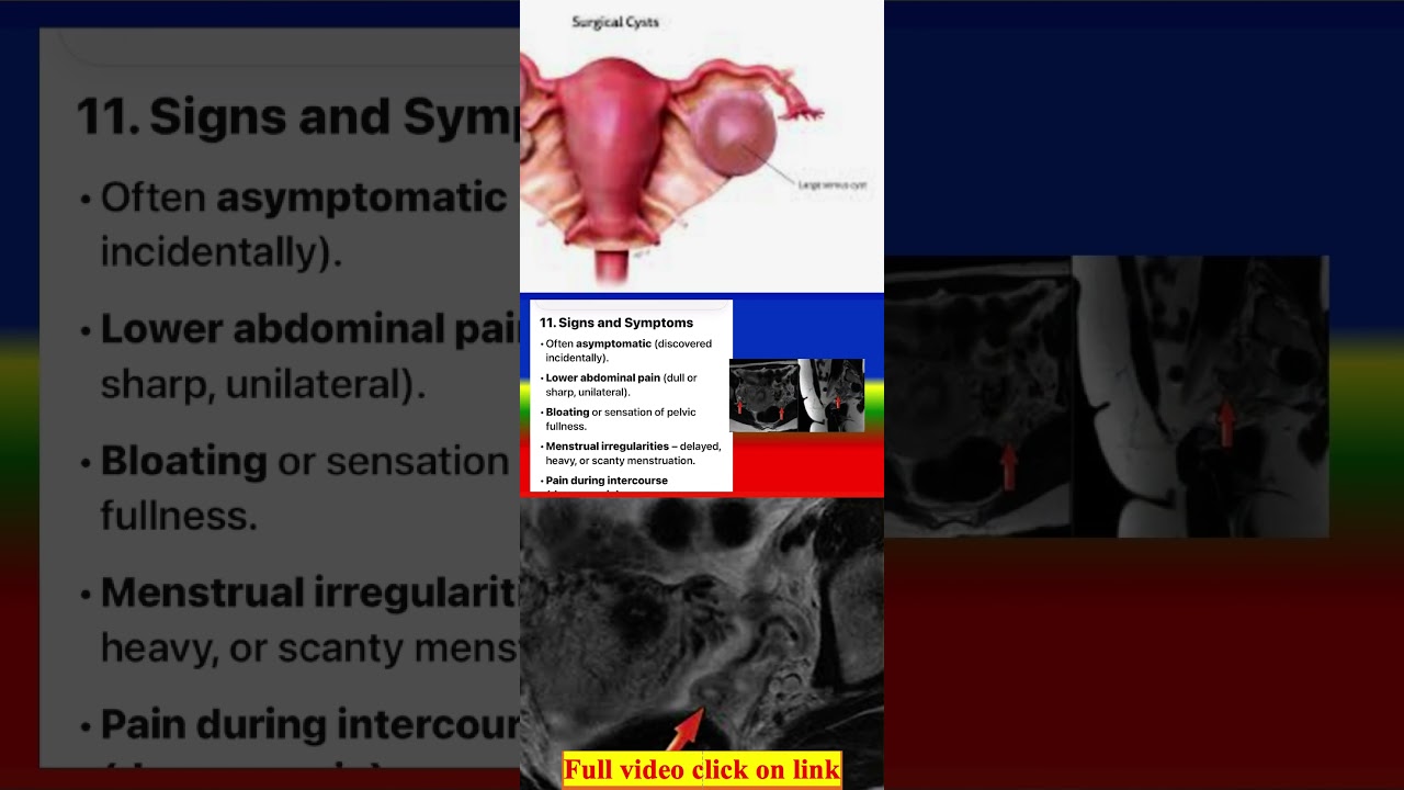 Follicular Cyst Signs and Symptoms  #medicalknowledgeonline #nurse #medicaldiagnosis