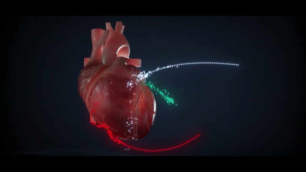 Scenaria View CT with Cardio StillShot for Cardiac CT