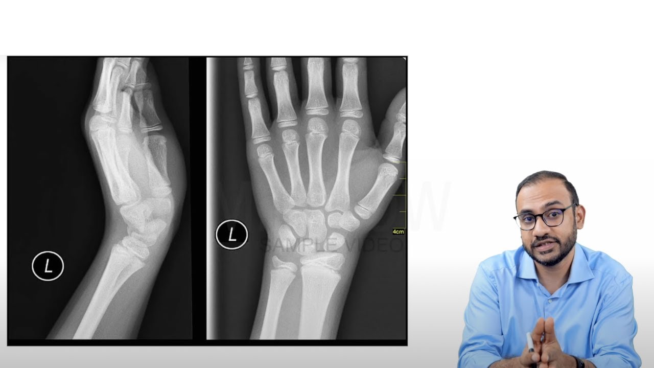Marrow E6 Revision Videos: Orthopaedics Sample Video