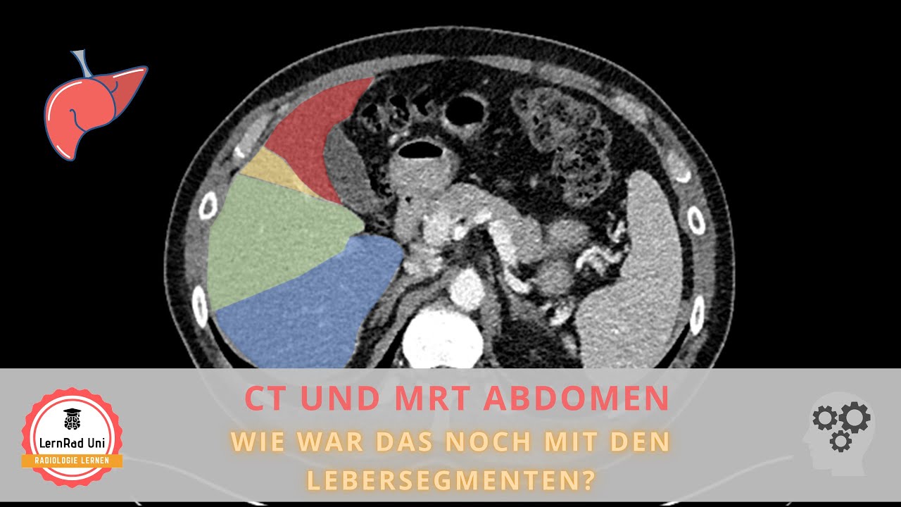 Lebersegmente in CT & MRT einfach erklärt – Schnittbildgebung Abdomen