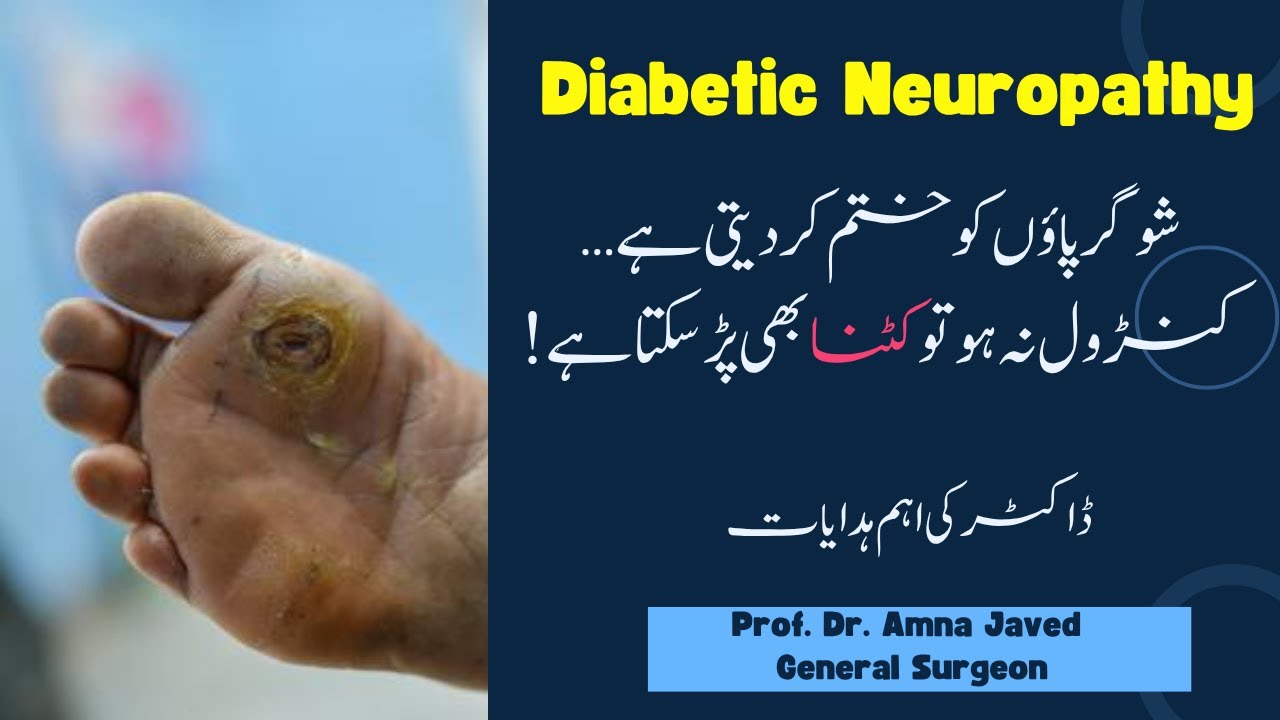 Diabetic Neuropathy The Warning Every Patient Must Hear!