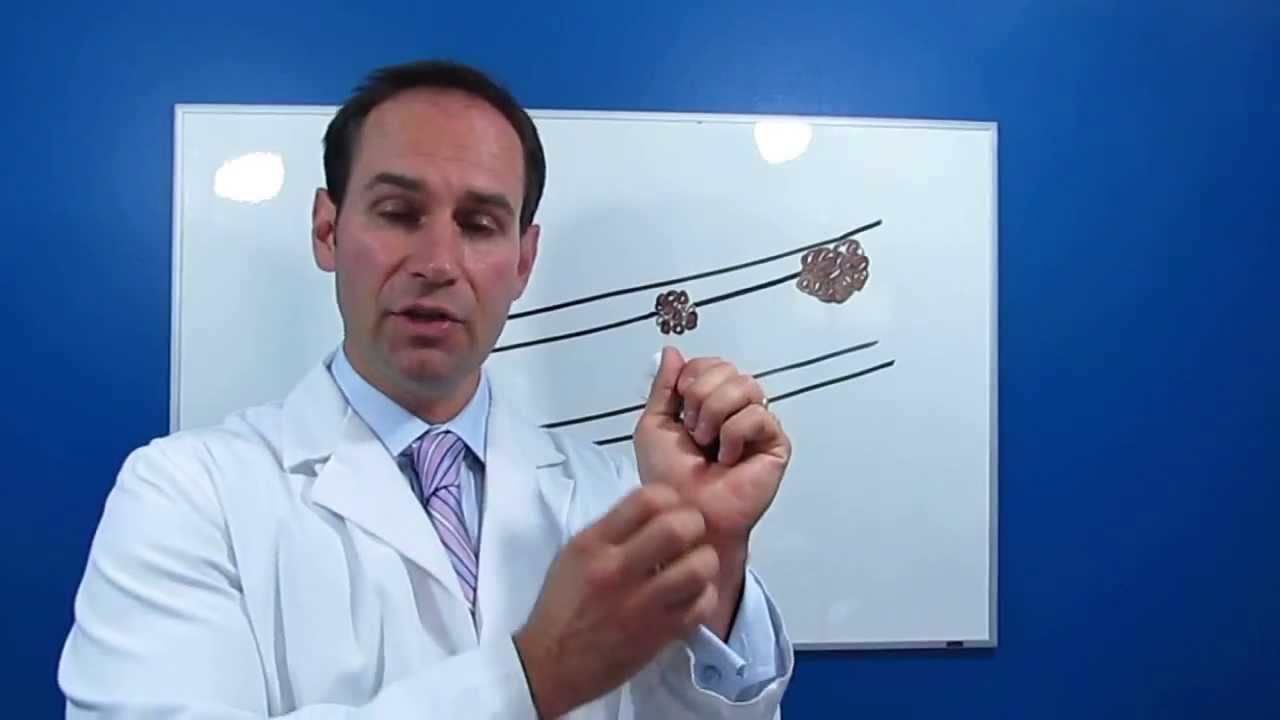Inflammation and Heart Disease Explained