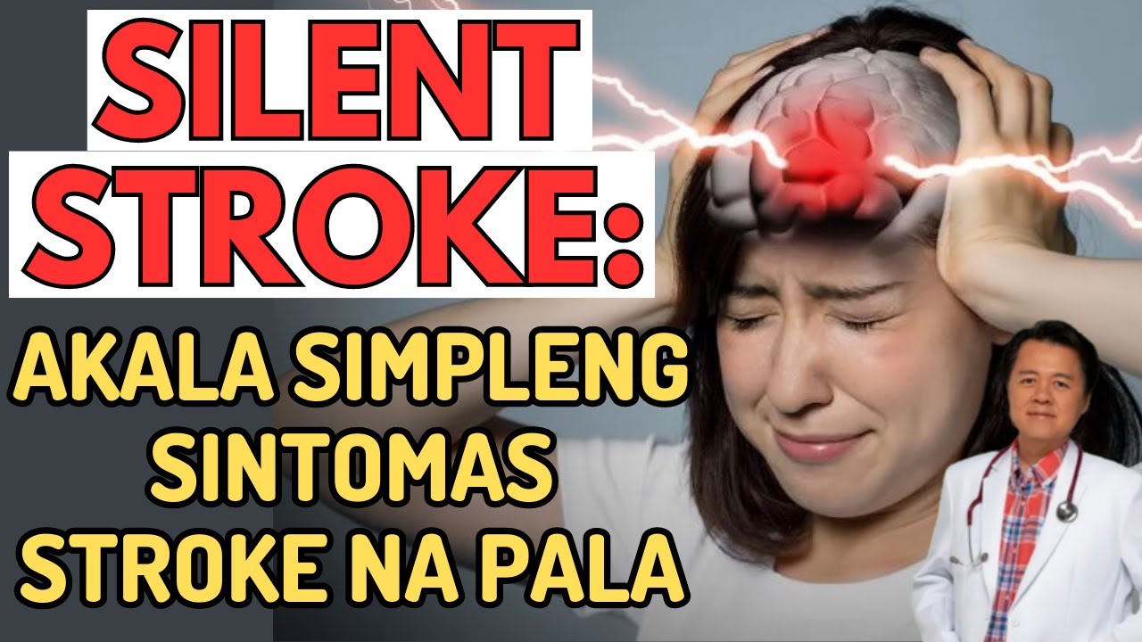 Silent Stroke: Akala Simpleng Sintomas Stroke na Pala. - Payo ni Doc Willie Ong