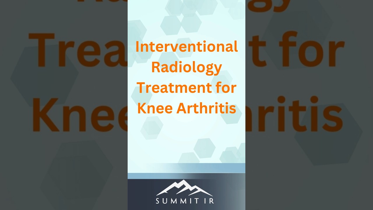 Genicular Artery Embolization: Treatment for Knee Osteoarthritis.