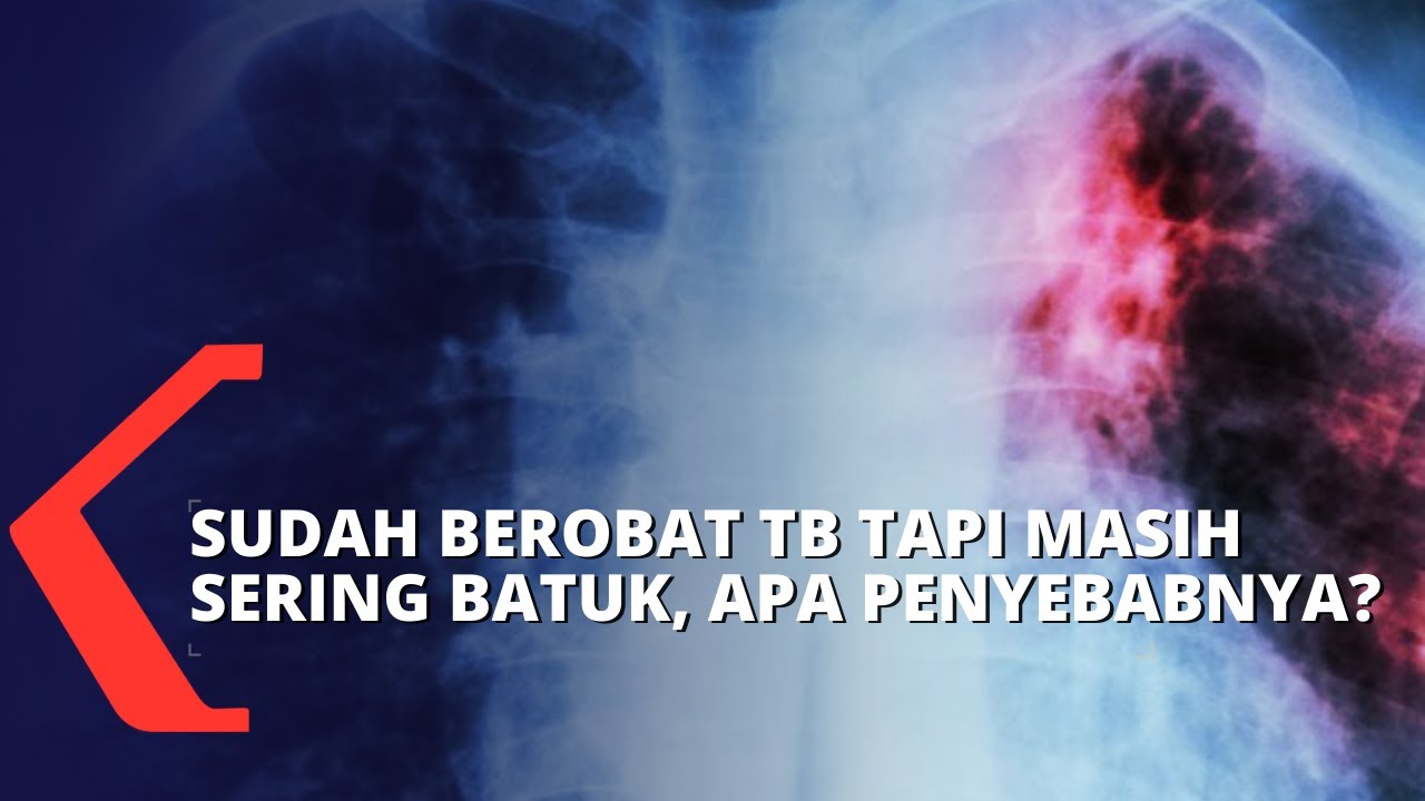 Sudah 5 Bulan Berobat TB Tapi Masih Sesak Napas dan Sering Batuk, Apa Penyebabnya?
