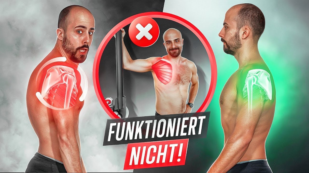 Rundrücken und vorgezogene Schultern beseitigen (+ warum DIESE Übungen nicht funktionieren)