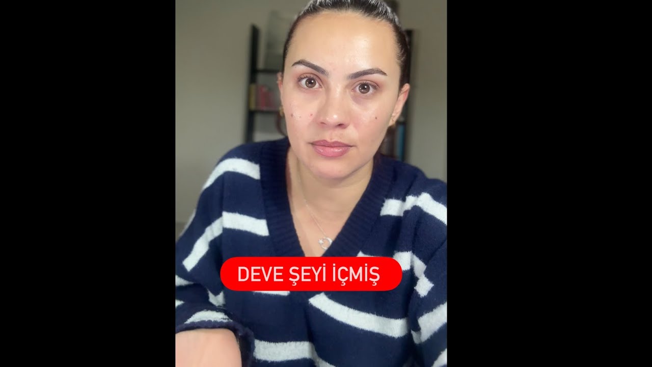 Bu Kadarına Pes Diyeceksiniz! Ne Yapmış?! 