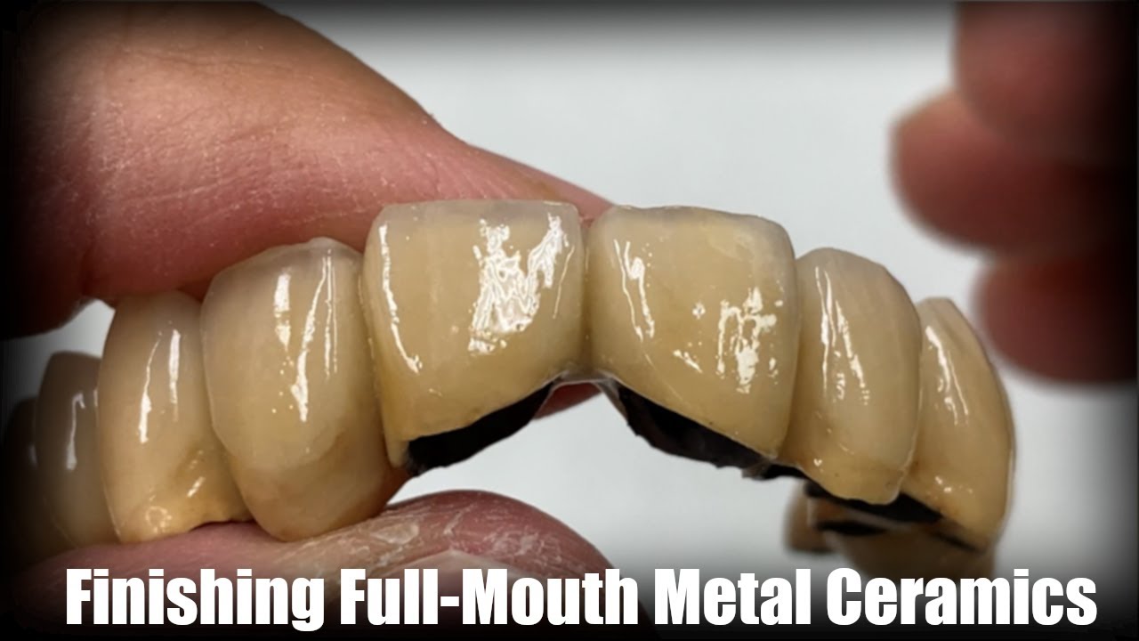 Finish Full-Mouth Metal Ceramics With Me