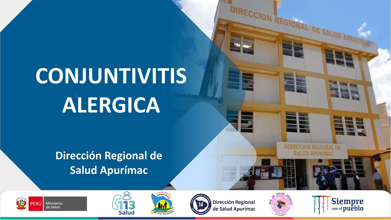 CONJUNTIVITIS ALERGICA
