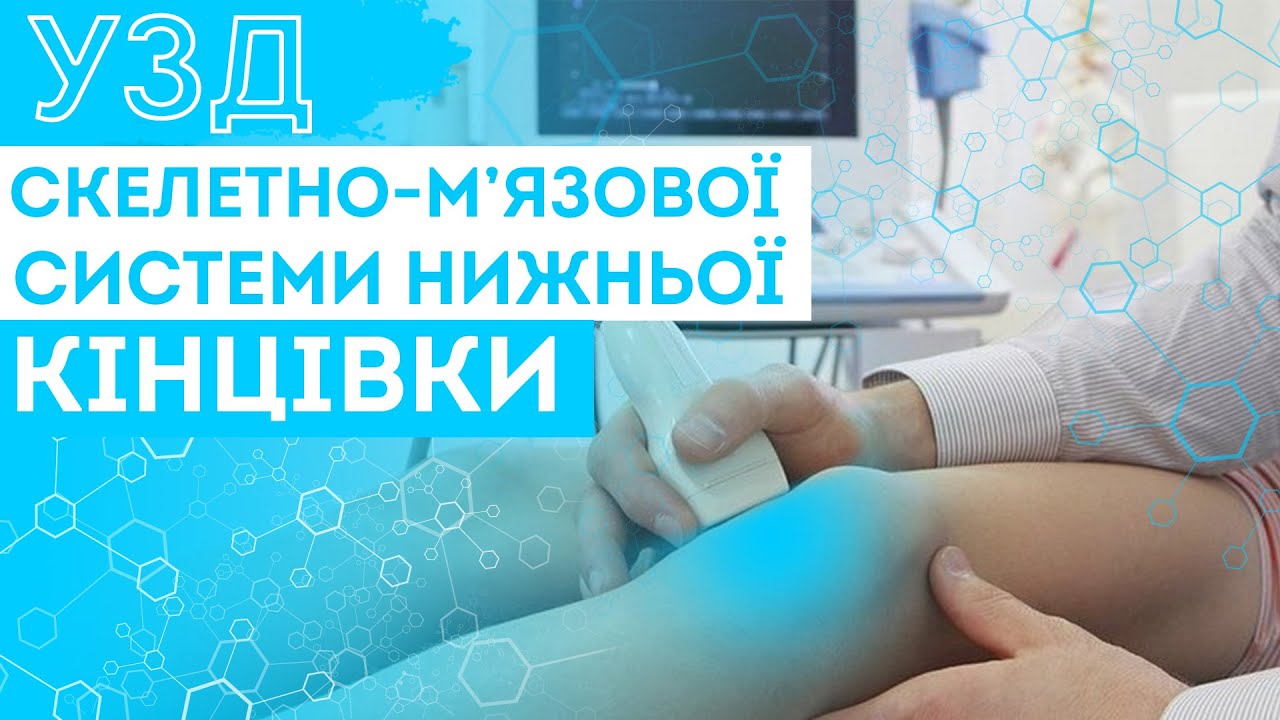 Ультразвукова діагностика скелетно-м’язової системи нижньої кінцівки
