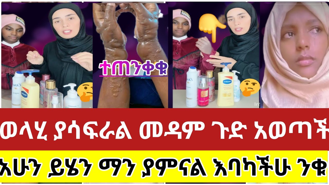 🔴#ወላሂ#ያሳፍራል#መዳም#ታዝባት#የሰራተኘዋን#ጉድ#አወጣች#እንደሷ#እንዳትሆኑ #ስሙት#አሁን#ይሄን#ማን#ያምናል#እባካችሁ#ንቁ#እራሳችሁን#ጠብቁ#ኬሚካል#ስደት 
