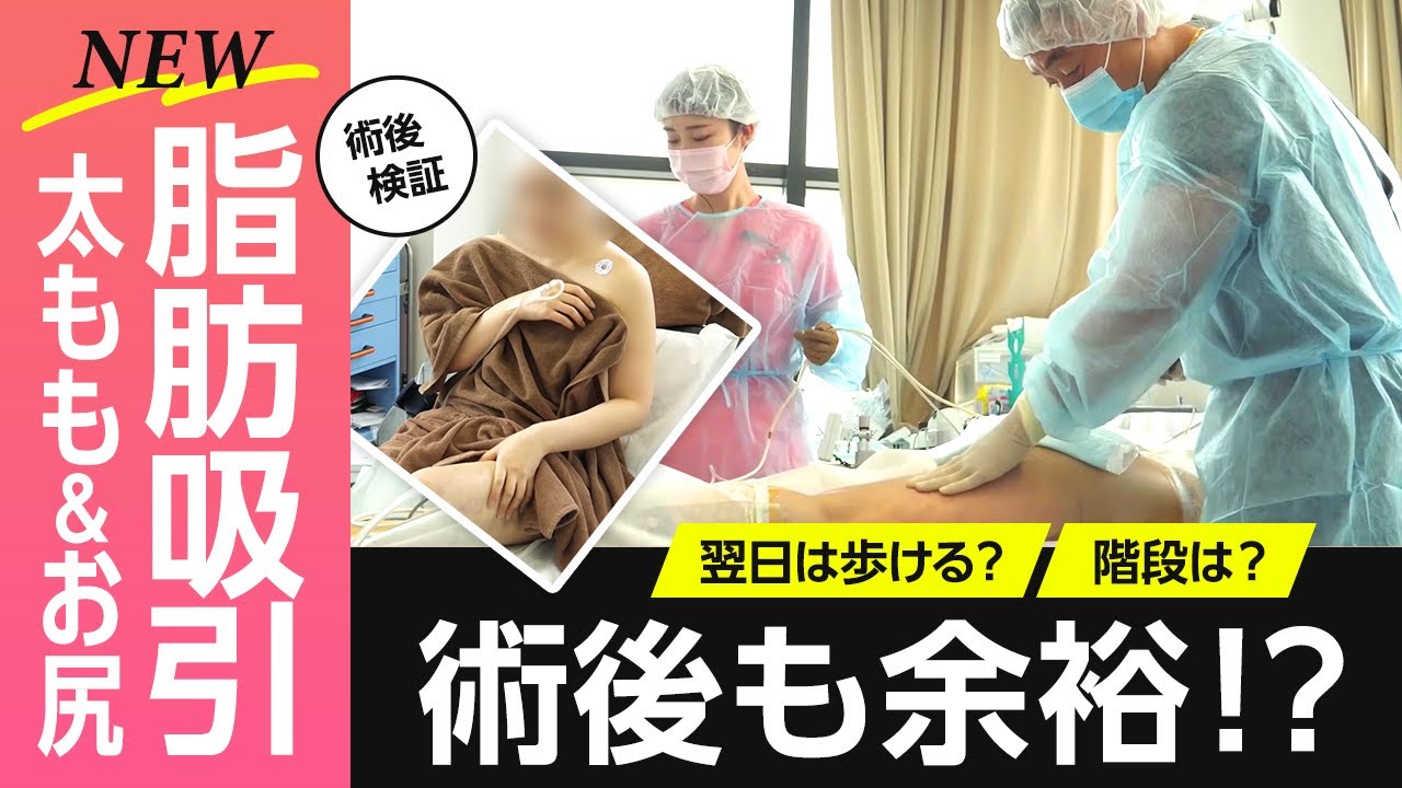【脚やせ】太ももの脂肪吸引の術後ってつらいの？翌日に階段上れるか、徹底検証しました！！【湘南美容クリニック】