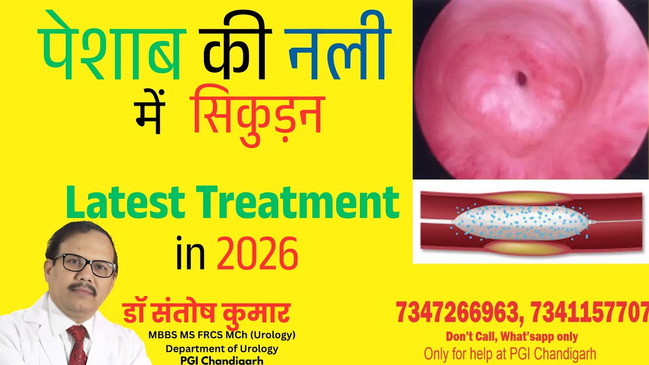 बार बार पेशाब की नली में सिकुडन (Urethral Stricture) Latest Treatment