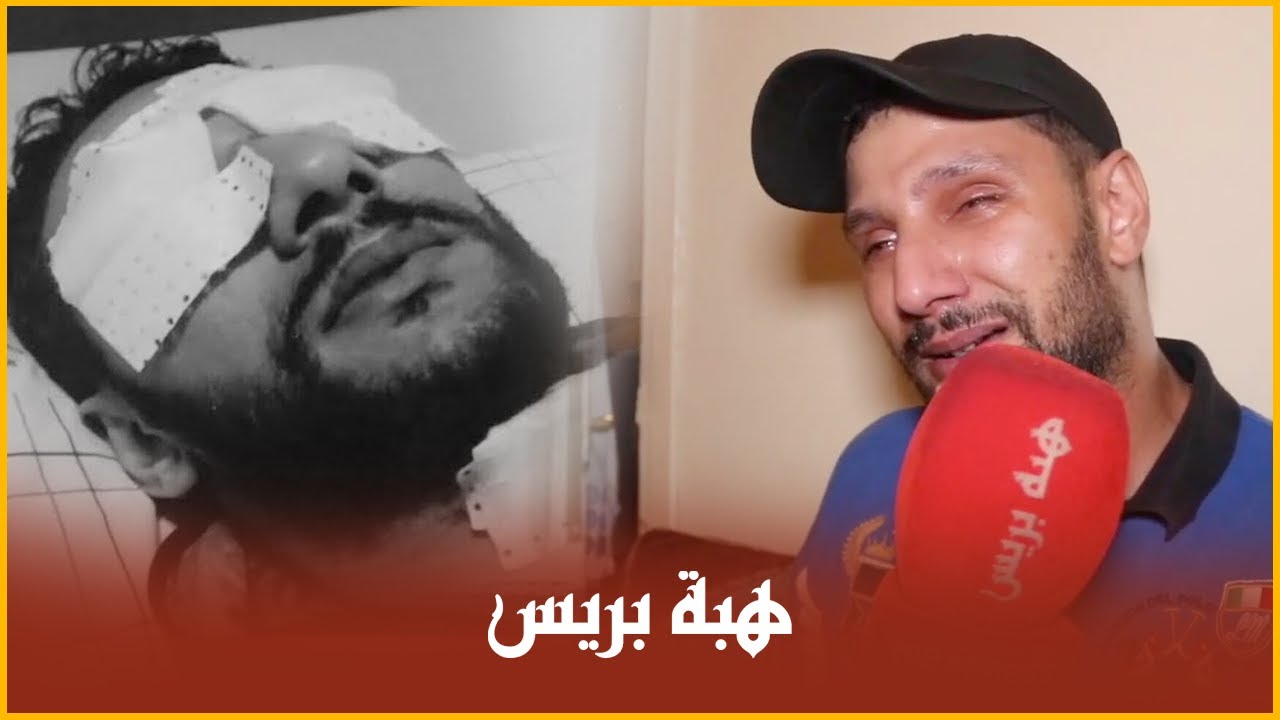 السجين الذي اقتلعت عيناه داخل سجن عكاشة  وفقد بصره يروي تفاصيل خطيرة