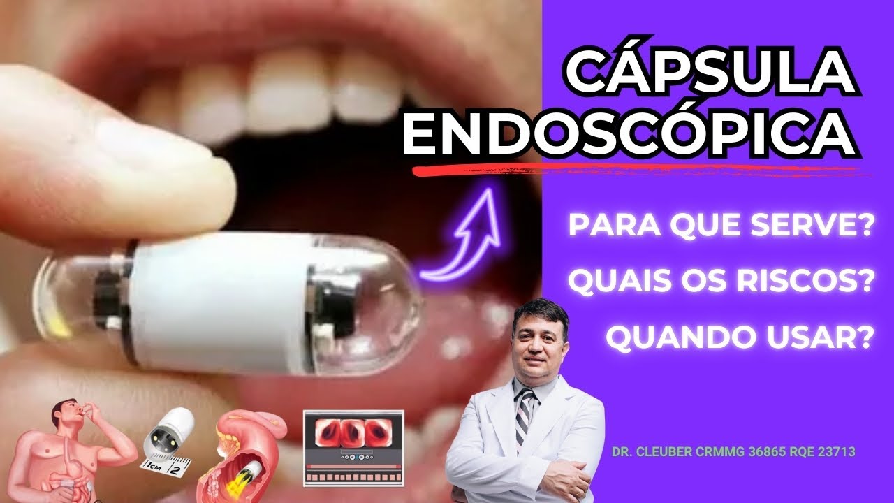 Cápsula Endoscópica: O Exame que Vê Onde a Endoscopia Não Chega
