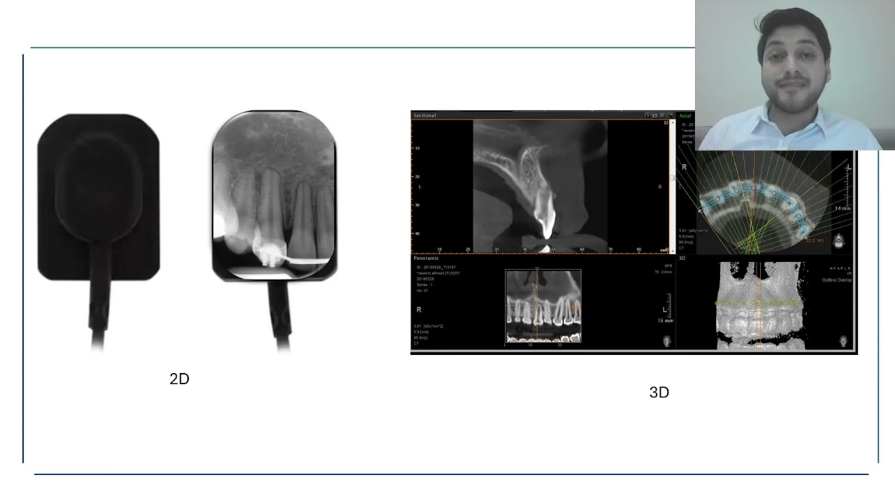 Root Resorption . Dr Wael Zaatari