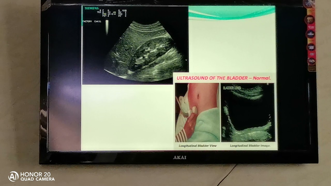 Radiology of urinary system