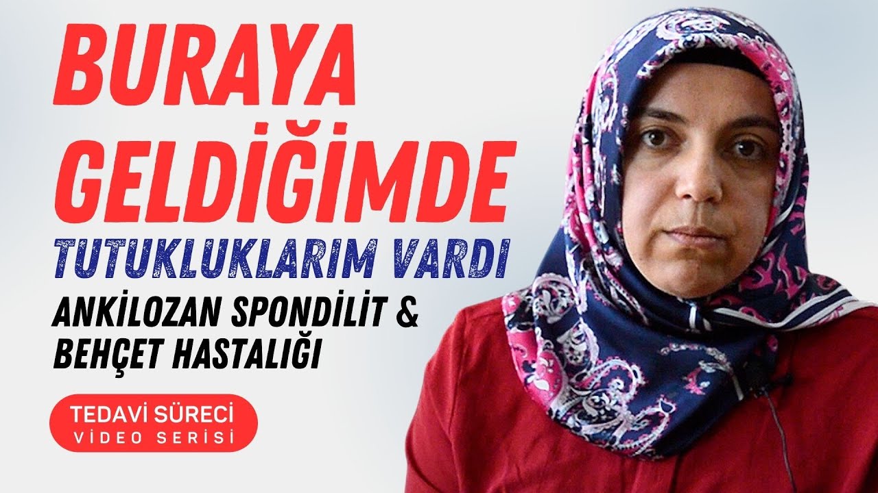 Ankilozan Spondilit Tedavisi - Sivas - Semiha Kunduz