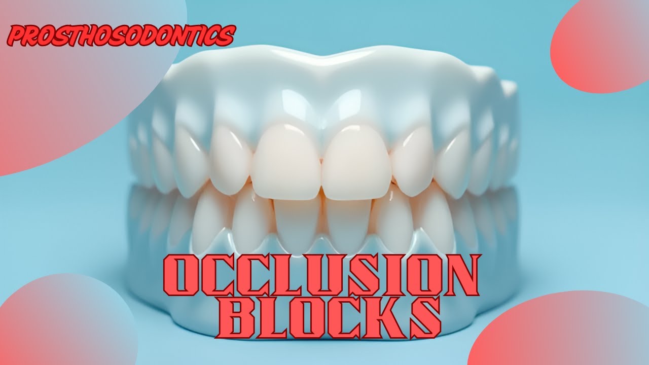 Prosthodontics Occlusion Blocks (Denture Record Blocks) (شرح بالعربي)