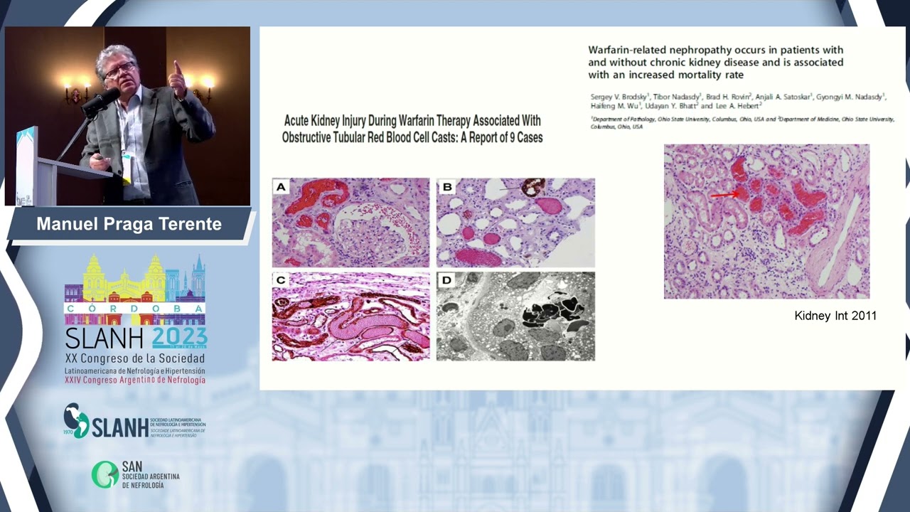 SLANH 2023 - CONFERENCIA PLENARIA HEMATURIA