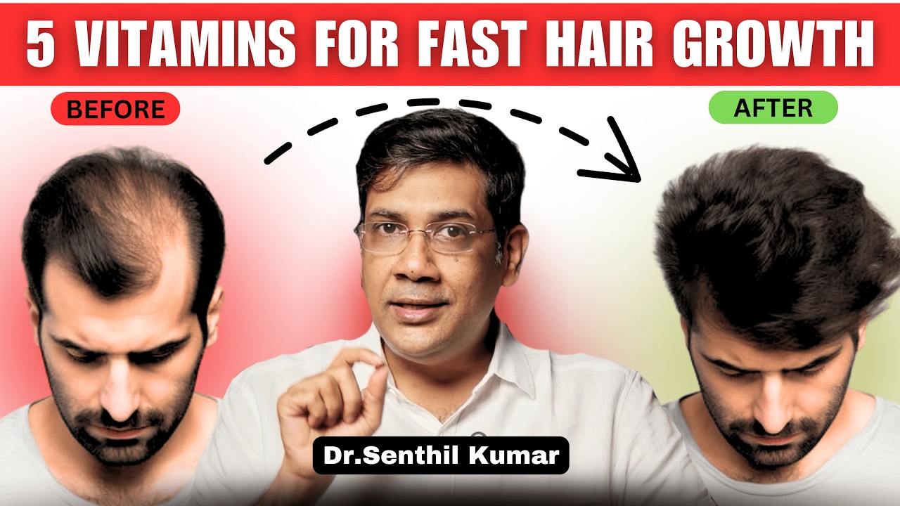 Выпадают волосы? Шампуни и масла не помогут! Возможно, причина в недостатке этих 5 витаминов!