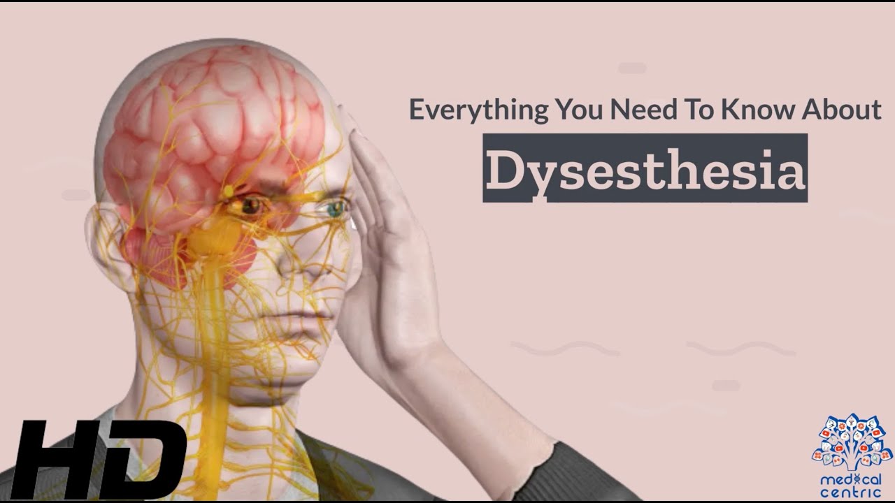 Dysesthesia 101: A Comprehensive Guide to this Mysterious Condition