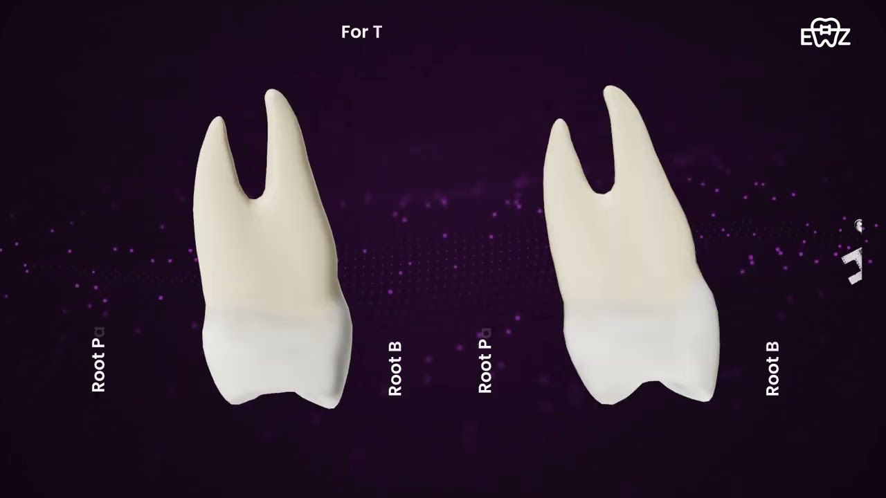 Revolutionizing Orthodontics | BaTR Brackets | 3D Innovation for Precision & Efficiency | Ezeebraces