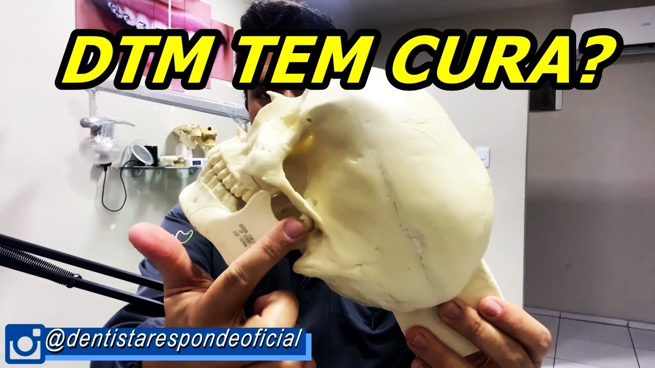 DTM (DISFUNÇÃO TEMPOROMANDIBULAR) | CAUSAS E TRATAMENTO.