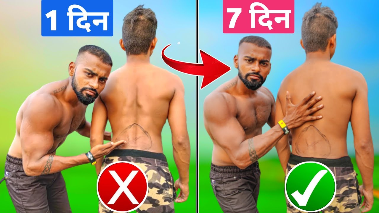How to Fix Anterior Pelvic Tilt - कमर के गड्ढे को ठीक करें - Fix Back Posture