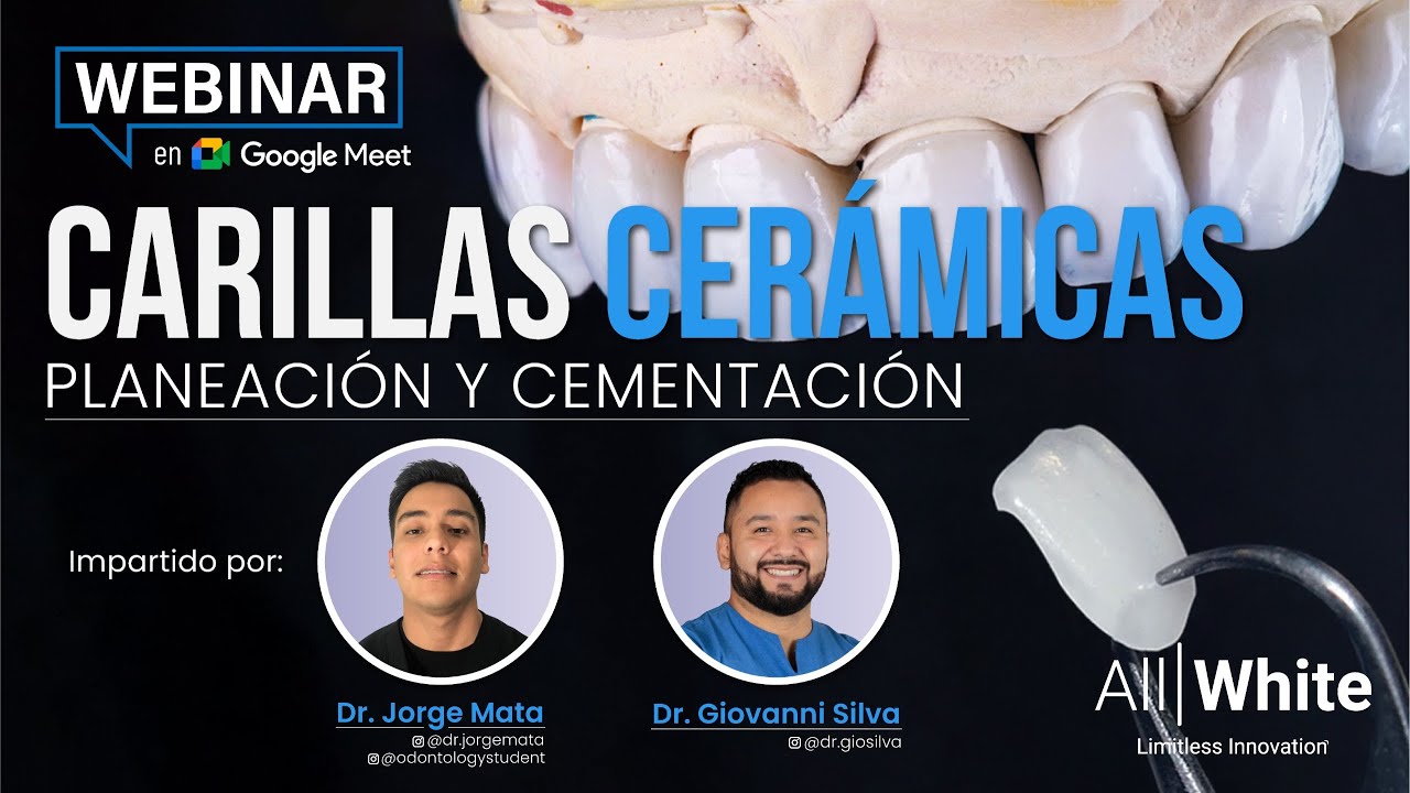 Carillas Cerámicas (Planeación & Cementación) - Dr. Giovanni Silva & Dr. Jorge Mata