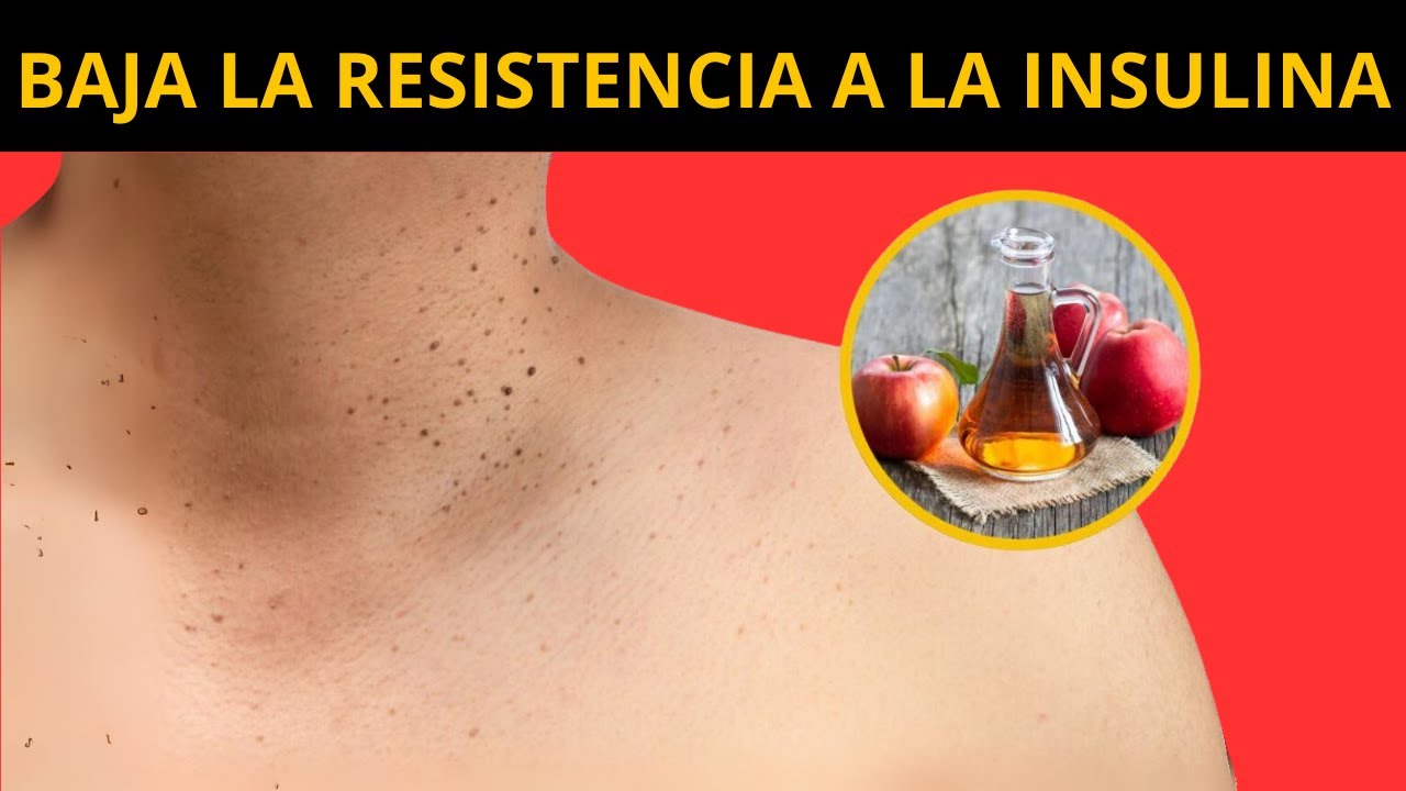 Los 10 MEJORES ALIMENTOS para la RESISTENCIA A LA INSULINA