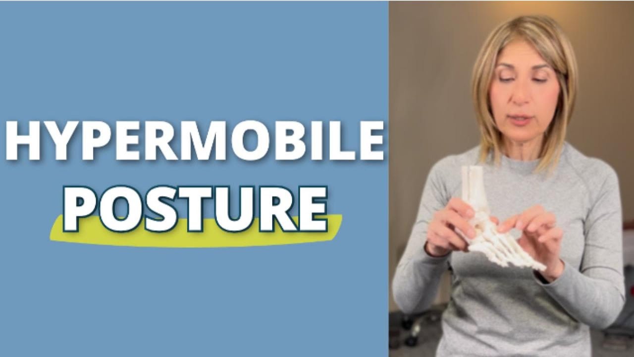 What Does Hypermobile Posture Look Like?  #hypermobility #posturecorrection #ehlersdanlos