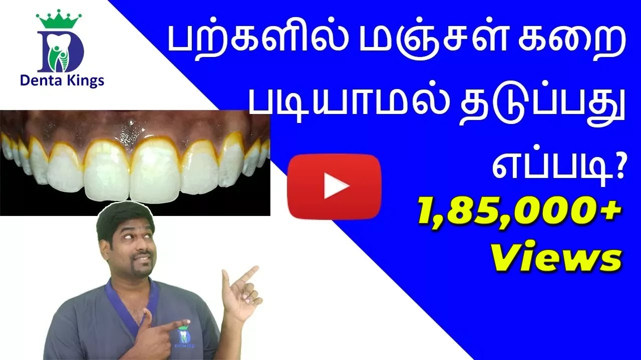 How to brush properly to avoid yellow deposites on your teeth | tamil explanation